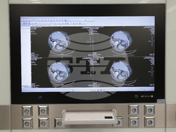 УМБАЛ „Света Екатерина“ - откриване на нов операционен блок