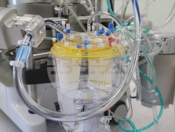 УМБАЛ „Света Екатерина“ - откриване на нов операционен блок