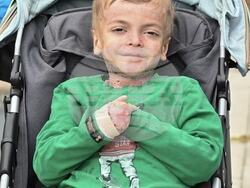 Гого от Перник - рядко заболяване - снимка: Юлия Димитрова/Личен Архив