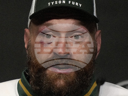 Fury Retirement Boxing