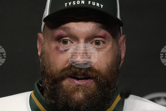 Тайсън Фюри обяви оттеглянето си от бокса