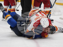 CORRECTION Flames Blues Hockey