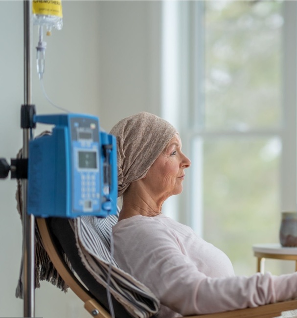 Много пациенти с рак изпитват нервни болки вследствие на химиотерапията, сочи проучване