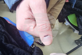 Косово - парламентарни избори - гласуване - секции