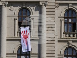 Serbia Parliament Injuries