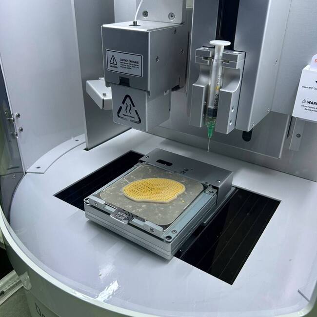 Старозагорски лекари спасиха крайник на жена от втора ампутация с помощта на 3D биопринтиране 