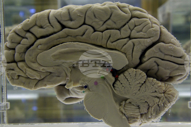 Вниманието работи на импулси, а не непрекъснато, установиха израелски учени