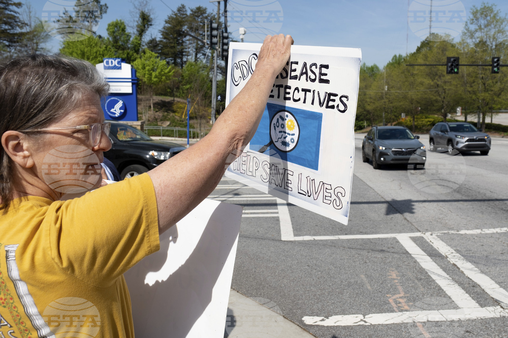Health Department-Layoffs