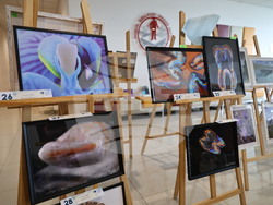 Пловдив - Медицински университет (МУ) - изложба