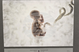 Плевен - фотоизложба - галерия "Илия Бешков"