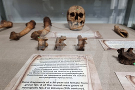 Варна - Музей по история на медицината - годишнина