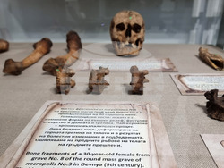 Варна - Музей по история на медицината - годишнина