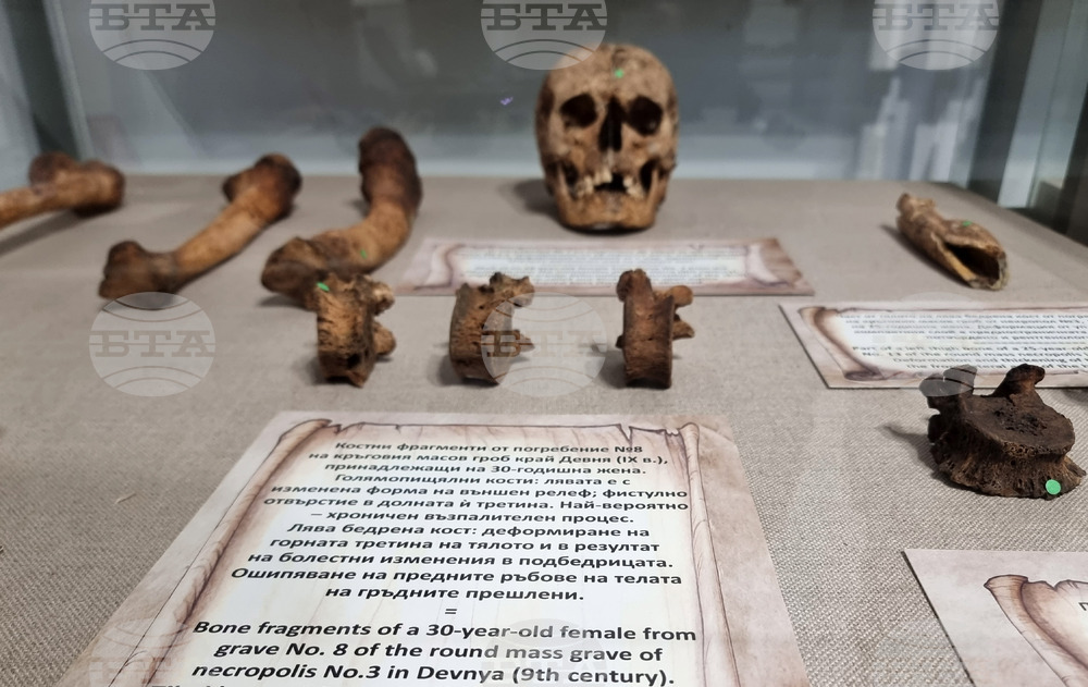 Варна - Музей по история на медицината - годишнина