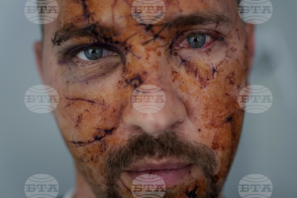 AP Top Photos of the Month April 2025