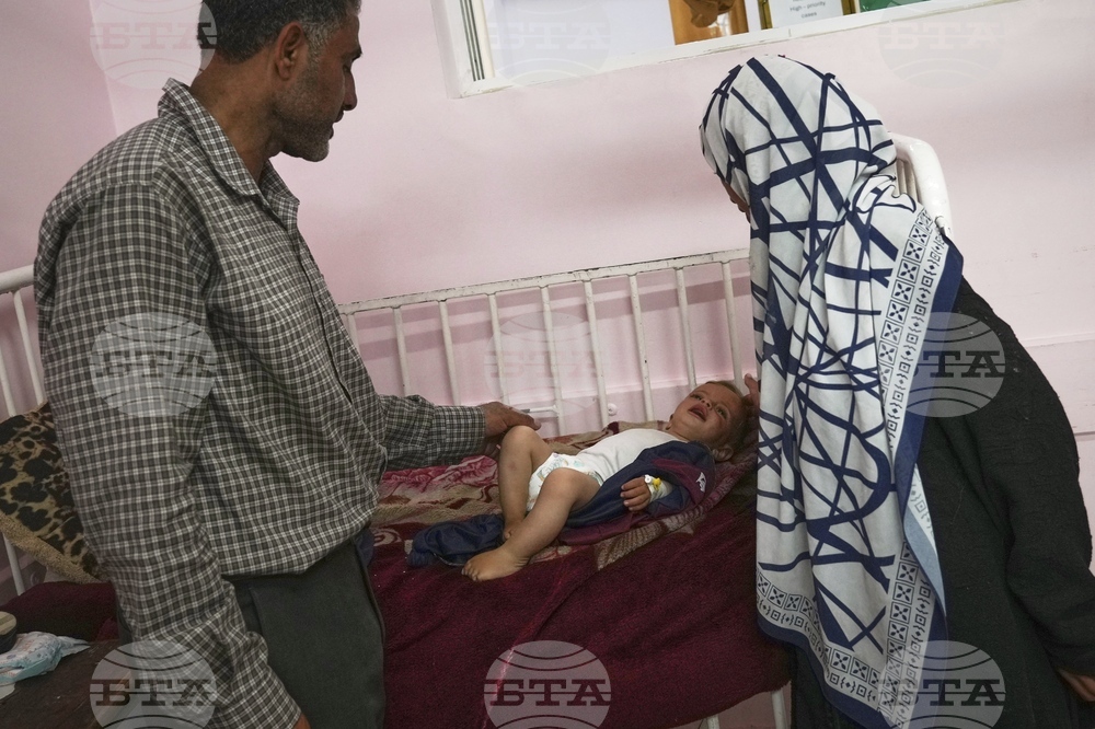 Mideast Wars Malnourished Children
