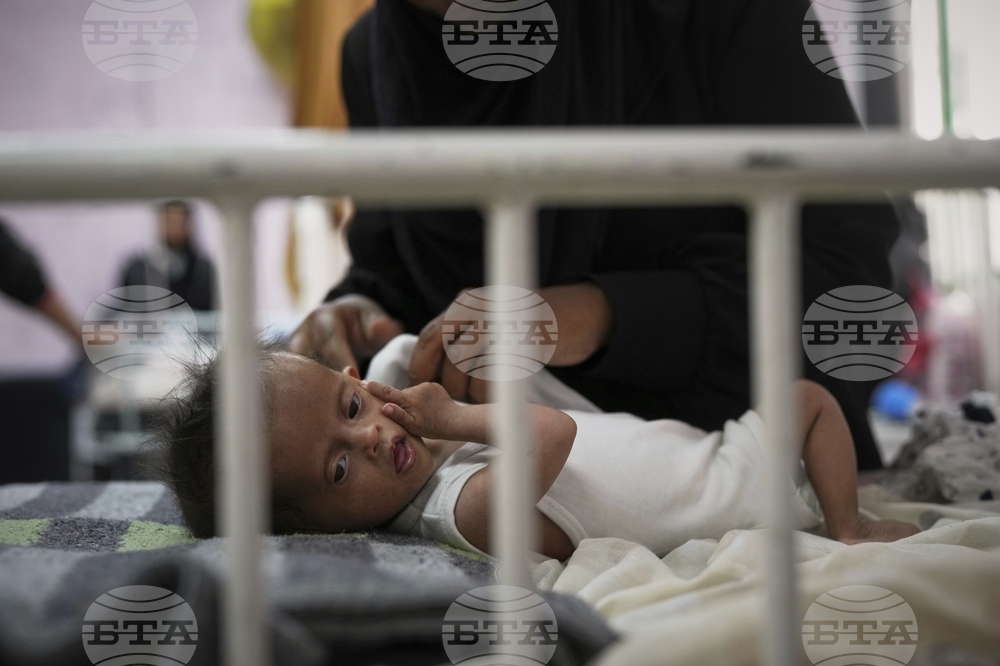 Mideast Wars Malnourished Children