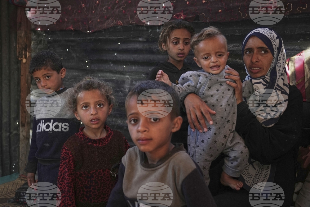 Mideast Wars Malnourished Children