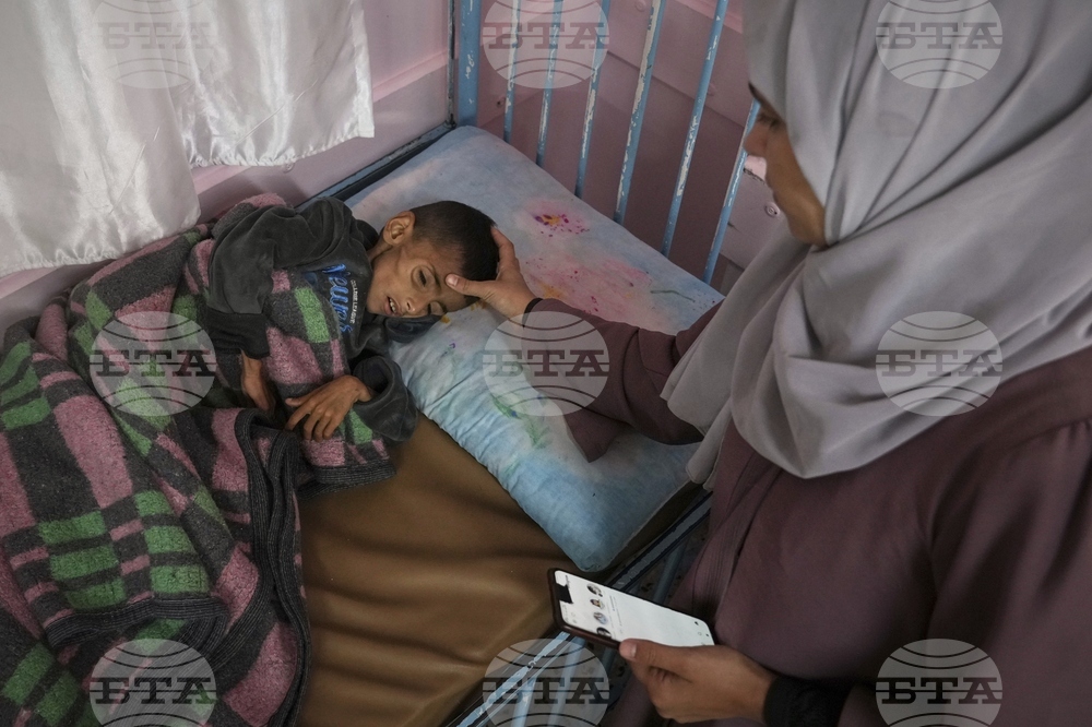 Mideast Wars Malnourished Children