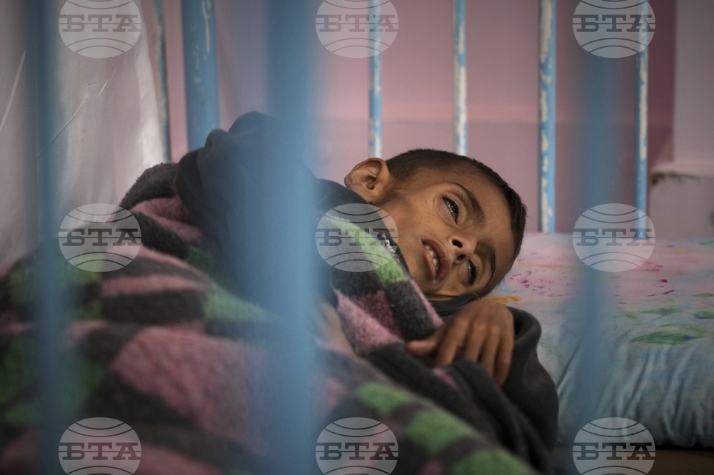Mideast Wars Malnourished Children