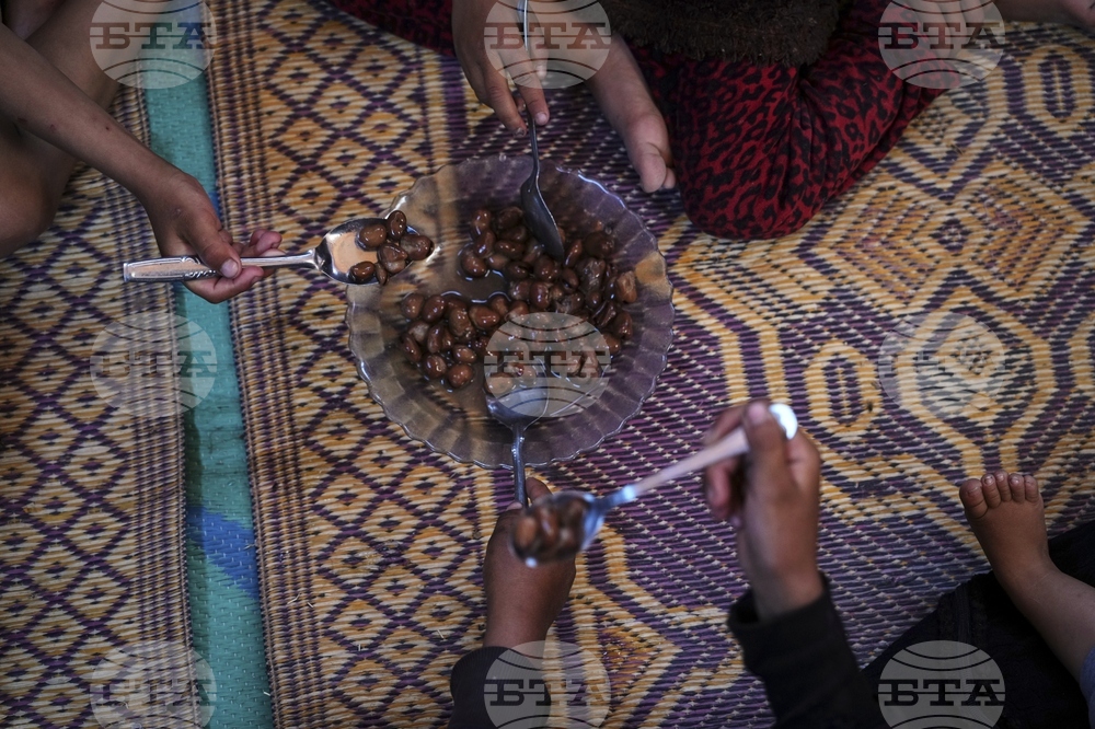 Mideast Wars Malnourished Children