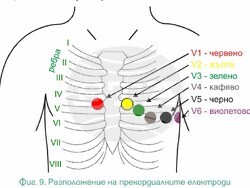Излиза ново актуализирано издание на „Как се разчита електрокардиограма“ от проф. Сотир Марчев. Снимка: „Труд“