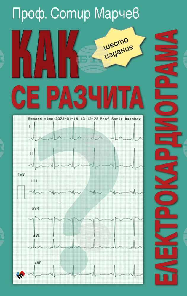 Излиза ново актуализирано издание на „Как се разчита електрокардиограма“ от проф. Сотир Марчев