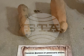 Варна - музей - история на медицината