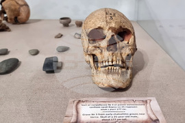 Варна - музей - история на медицината