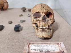 Варна - музей - история на медицината