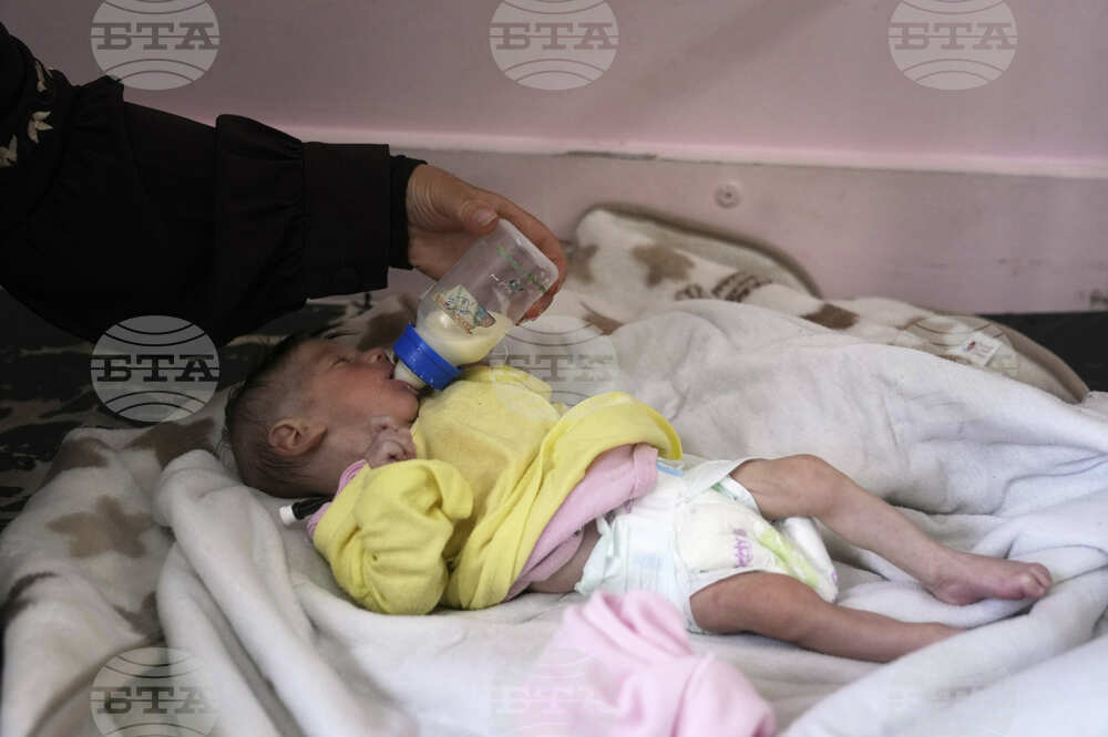 Mideast Wars Gaza Malnutrition