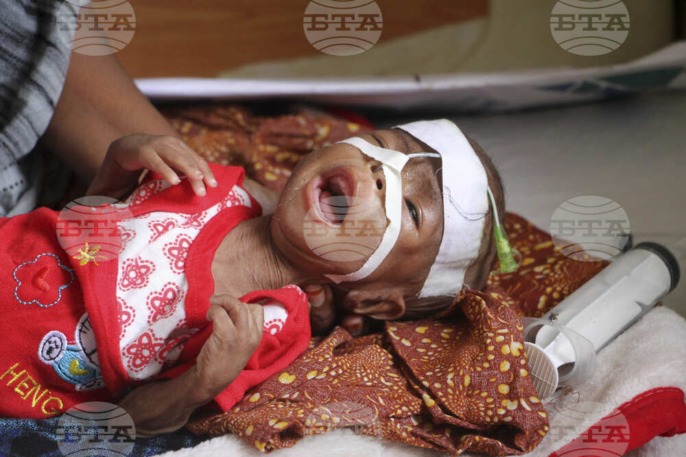 Somalia Hunger USAID