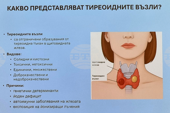 Над 300 000 пациенти са приемали медикаменти за щитовидната жлеза, показват данни за 2024 г.