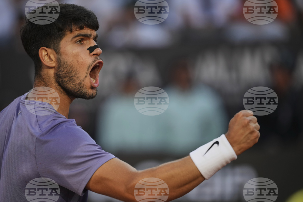 French Open Nose Strips Tennis