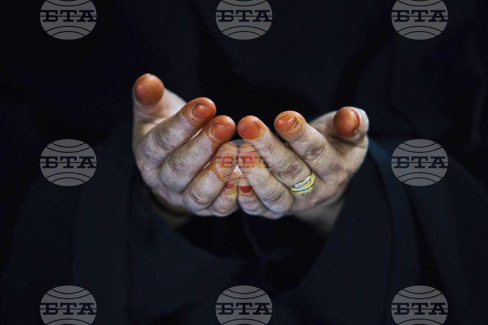 Pictures of the Week Global Photo Gallery