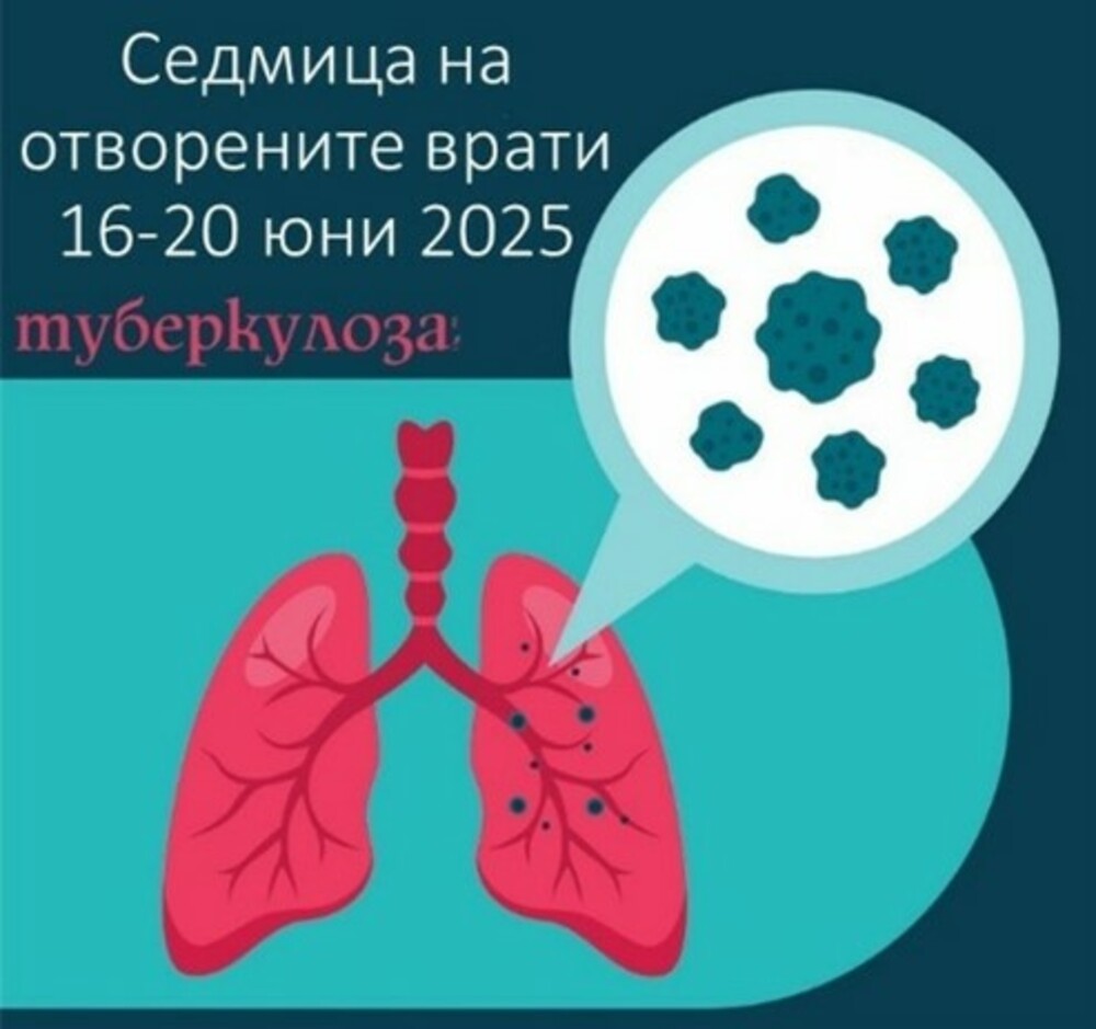 РЗИ – Разград: „Седмица на отворените врати“ от 16 до 20 юни 2025 г. обяви Министерство на здравеопазването, с цел намаляване заболеваемостта от туберкулоза