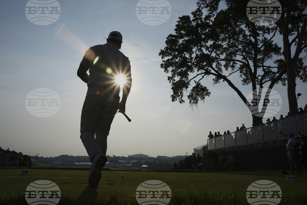 APTOPIX US Open Golf