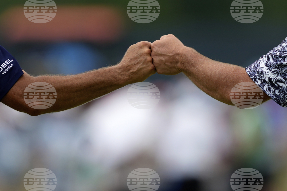 APTOPIX US Open Golf
