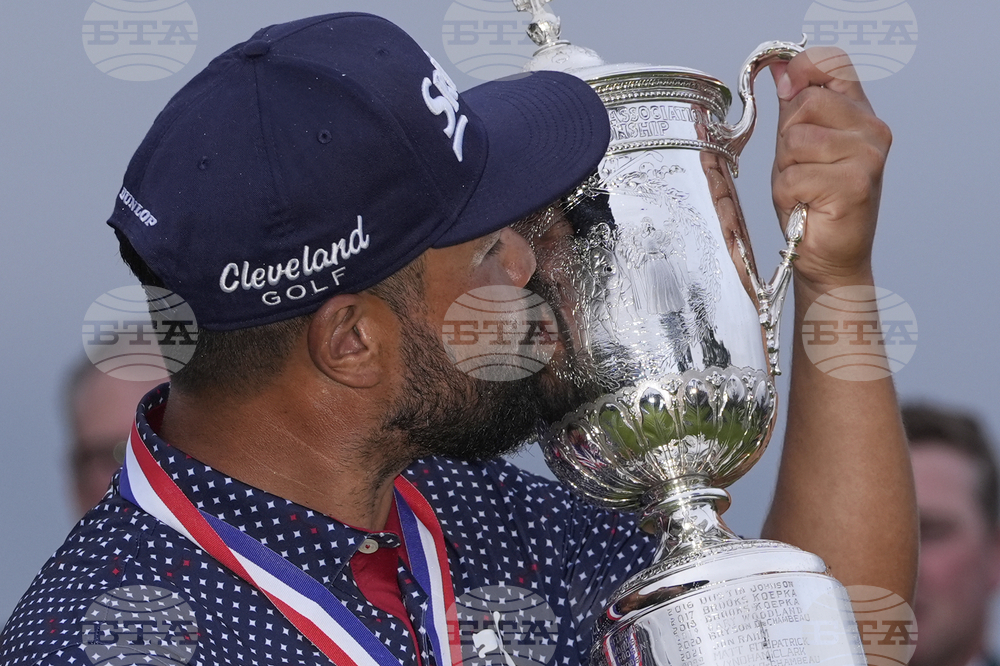 APTOPIX US Open Golf