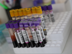 Благоевград - болница - обновено отделение - откриване