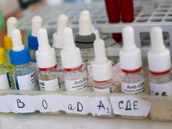 Благоевград - болница - обновено отделение - откриване