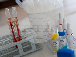 Благоевград - болница - обновено отделение - откриване