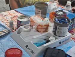 Разград - диабет - скрининг