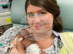 Premature Birth Record