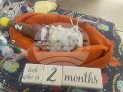 Premature Birth Record