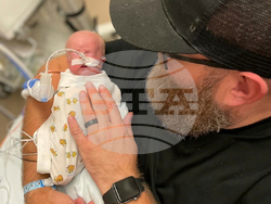 Premature Birth Record