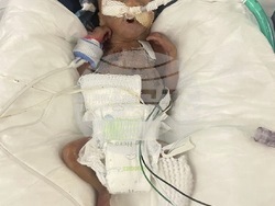 Premature Birth Record