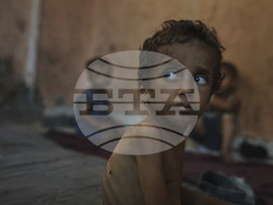 Mideast Wars Dying of Hunger