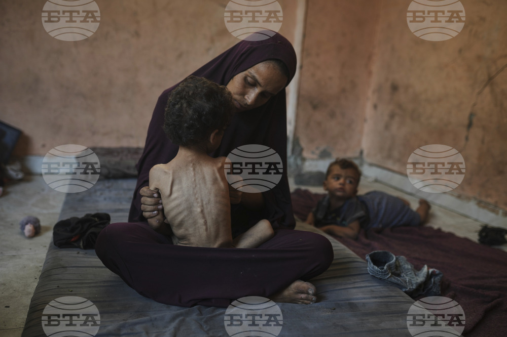 APTOPIX Mideast Wars Dying of Hunger
