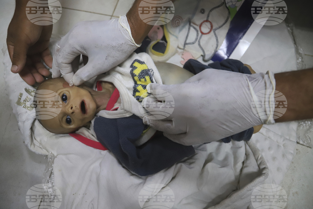 Mideast Wars Baby Starves