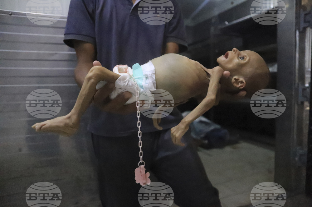 Mideast Wars Baby Starves